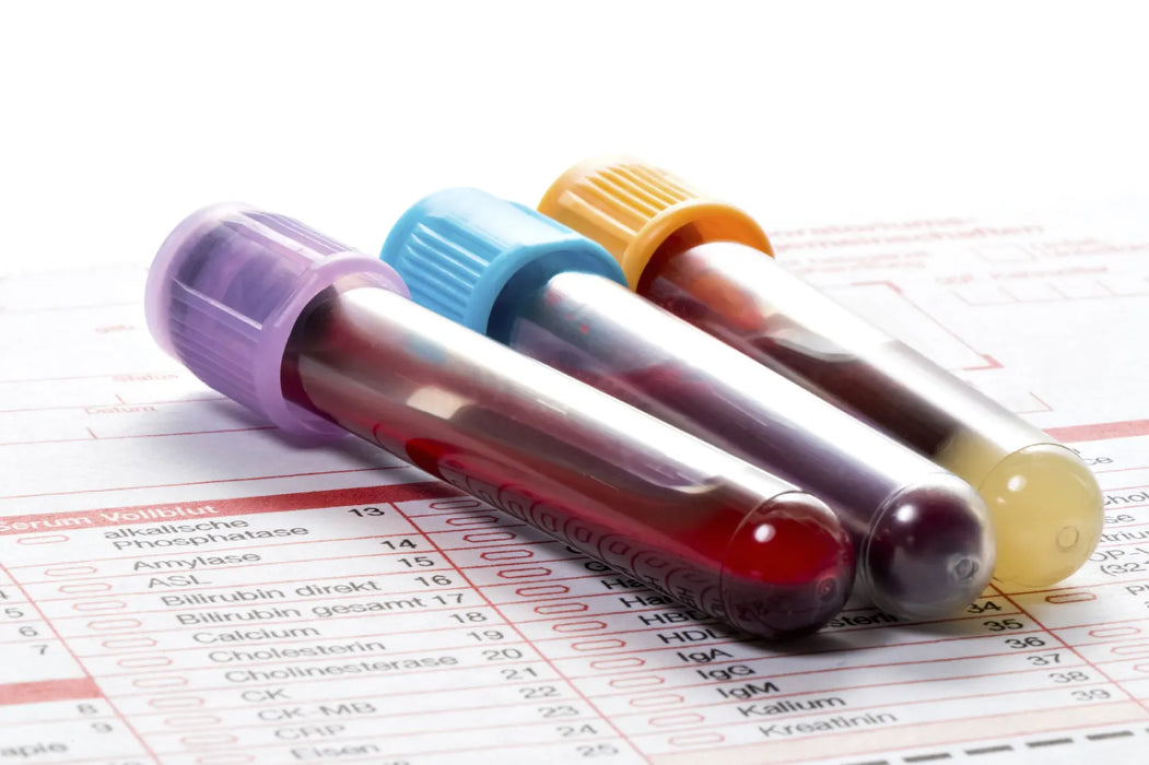General blood tests