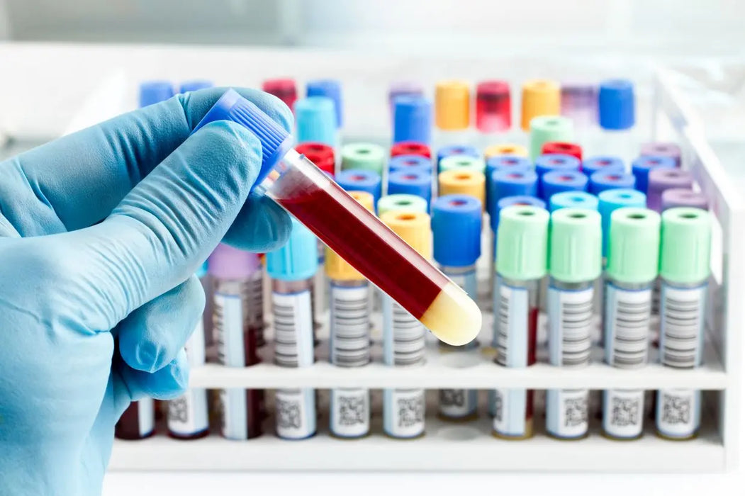 General blood tests