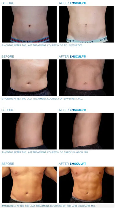 Emsculpt Neo Body sculpting